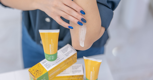 Comment nourrir la peau en cas de psoriasis ? Crème naturelle aux plantes
