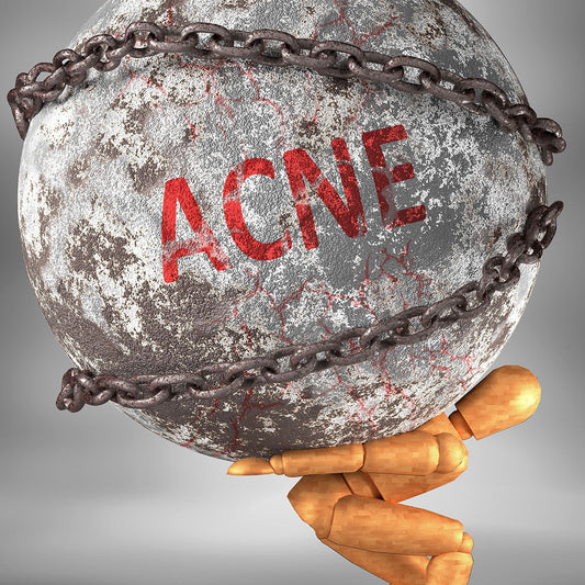 Acné liée au stress et soin naturel apaisant InaEssentials