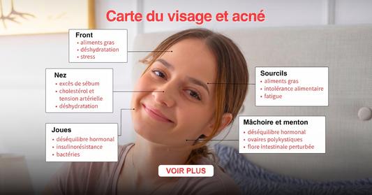 Carte du visage en cas d'acné par zones