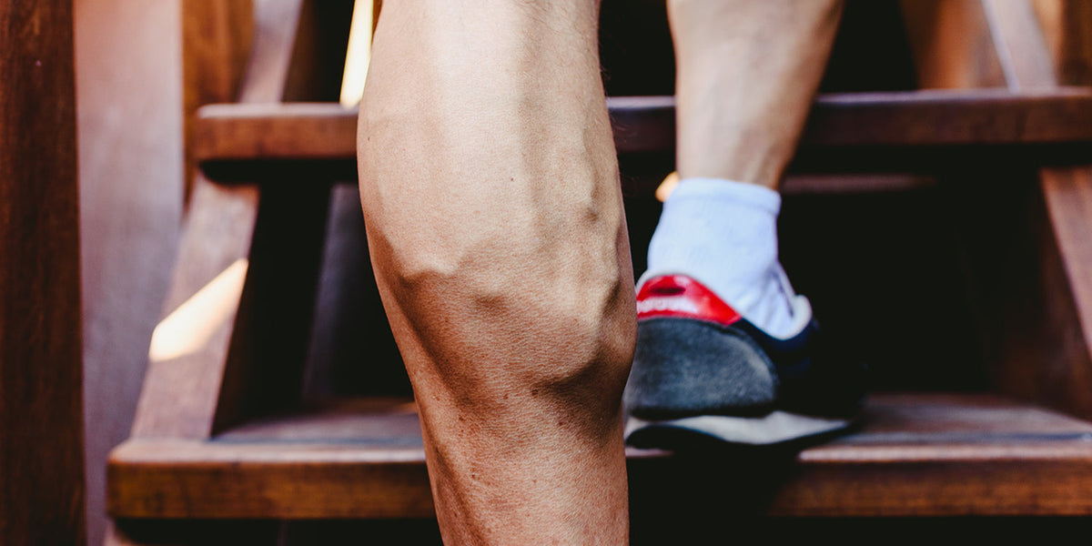Varices et fitness - comment les prévenir