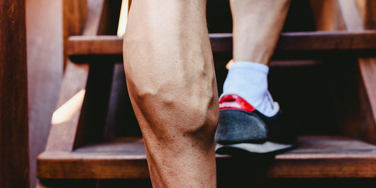Varices et fitness - comment les prévenir