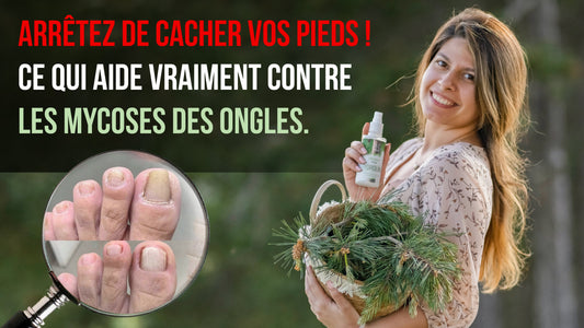 Pin blanc - La solution contre les mycoses des ongles dont personne ne parle