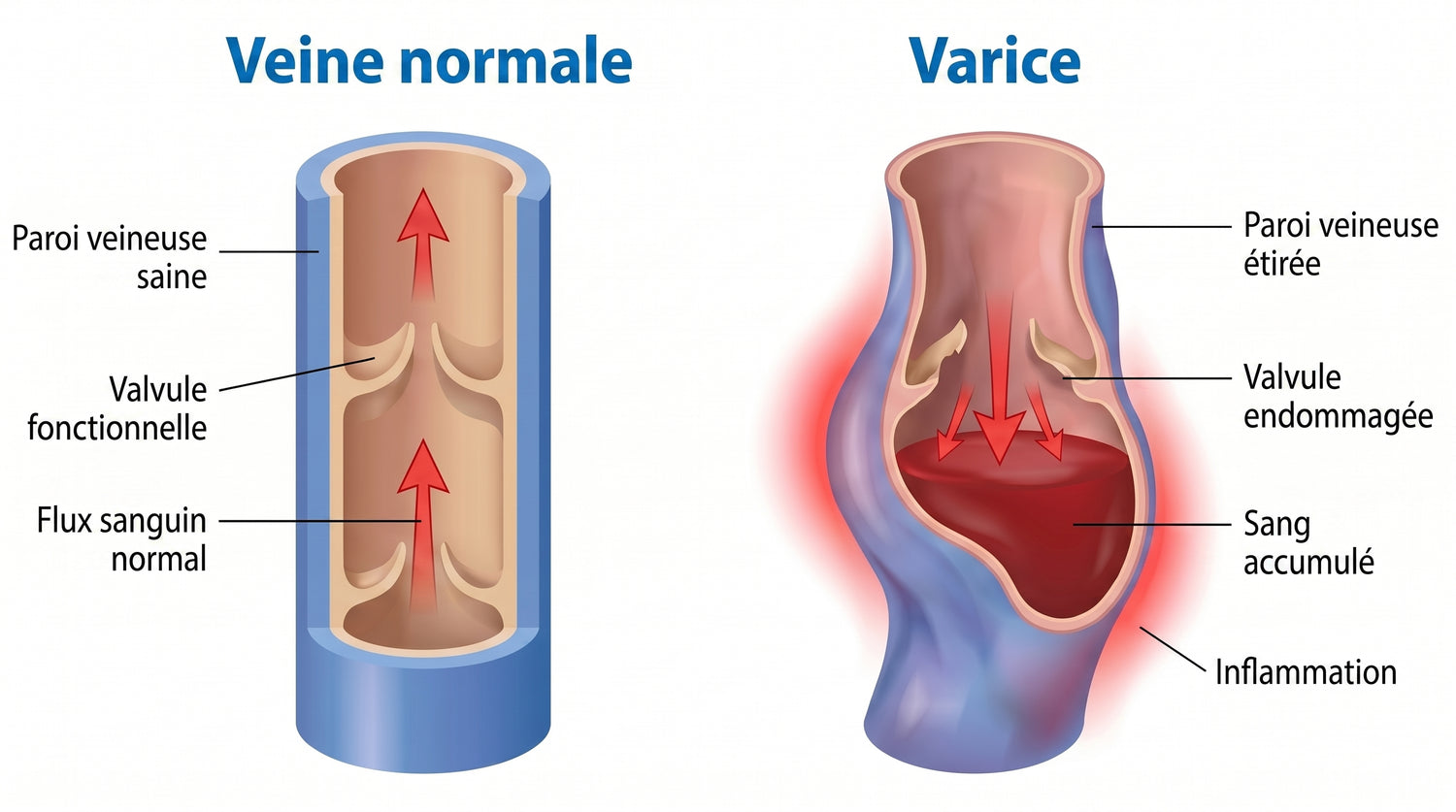 periodontis_fr