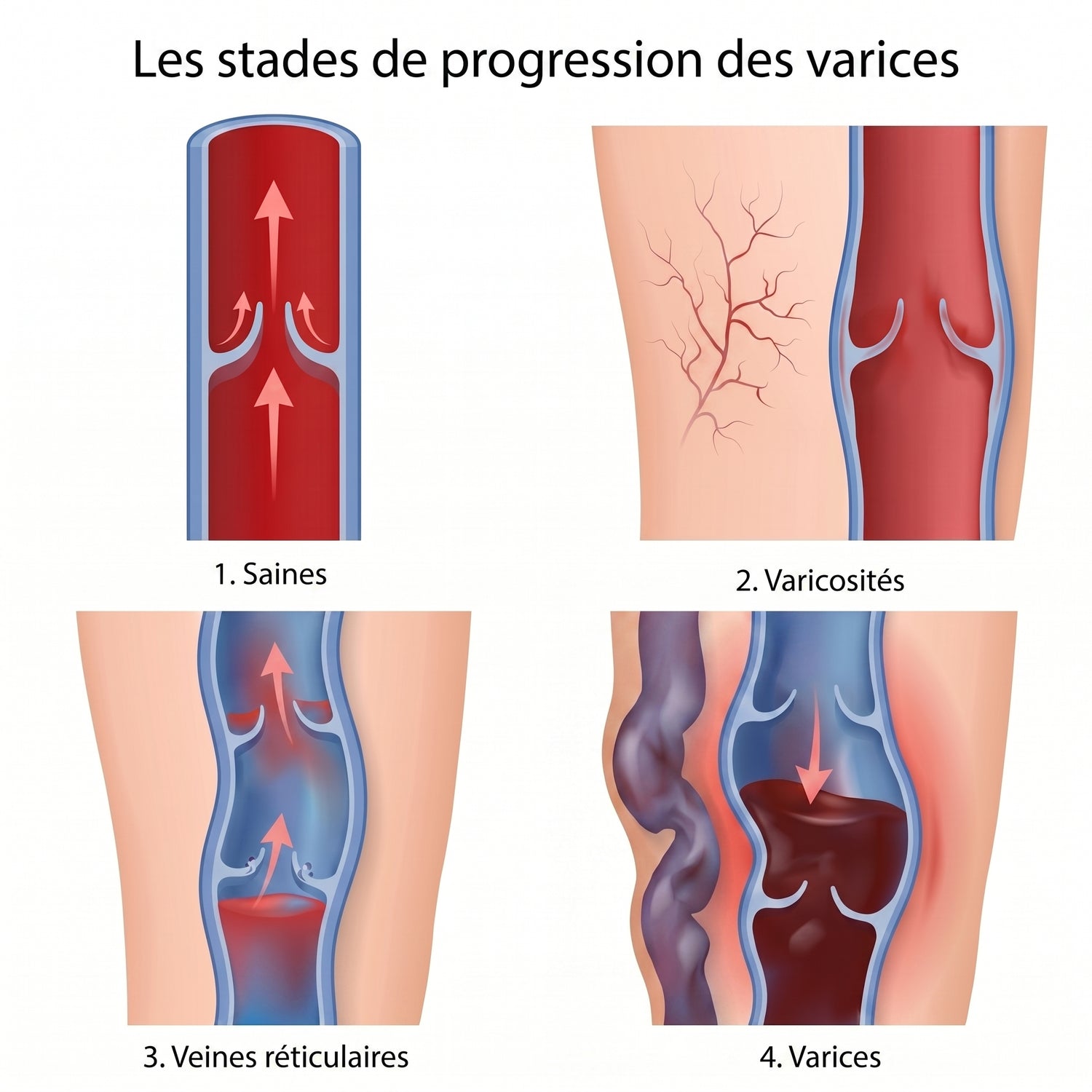 shutterstock_4stages_fr